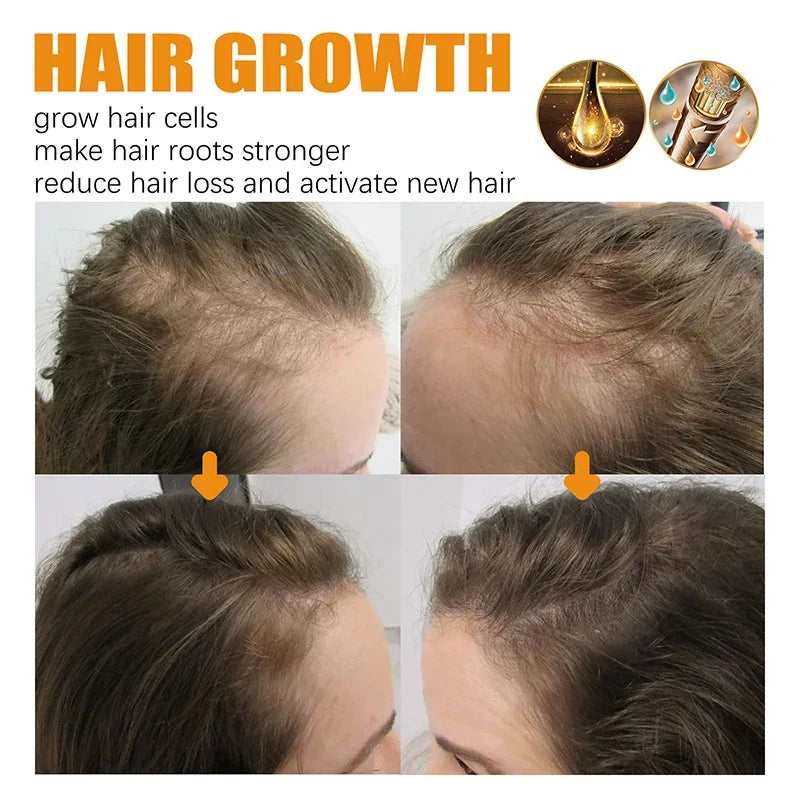 Shampoo Anti Hair Loss Serum Biotin Fast Hair Growth