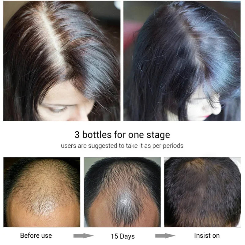 Shampoo Anti Hair Loss Serum Biotin Fast Hair Growth